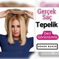 Deri Görünümlü Tepelik