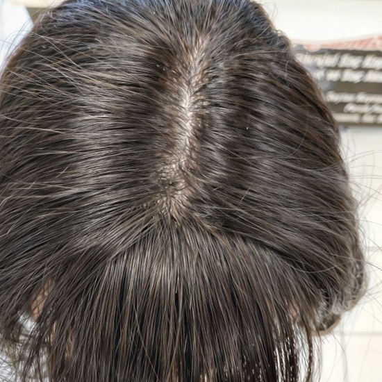 Gerçek Saç Bayan Peruk Tepe Kısmı Deri Görünümlü El İsciiliği Kişiye Özel Peruk Ankara Peruk