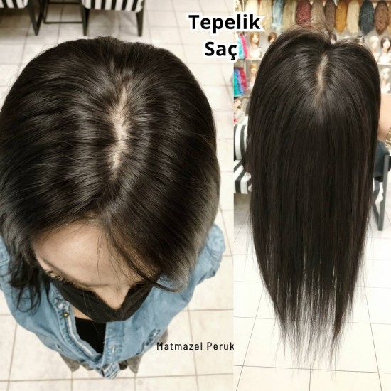 Tül Tepelik İpek Taban Saç Seyrekliği İçin