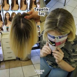 Tepe Kısmındaki Seyrek Saçlar İçin Tül Tepelik İpek Taban Tepelik 