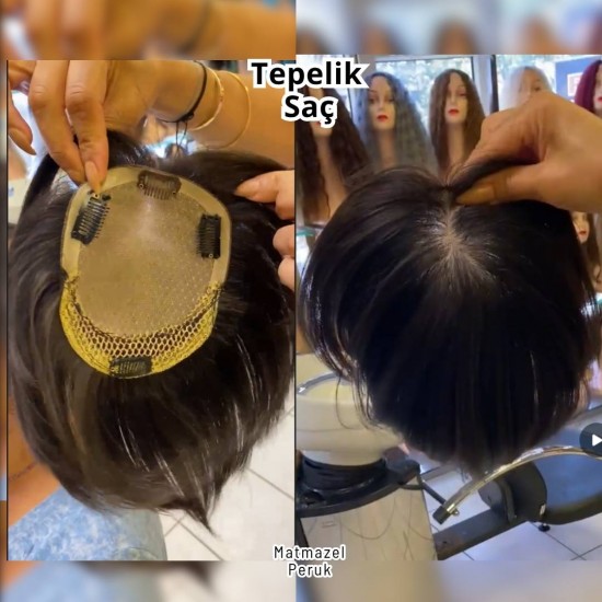 İpek Taban Alt Yapısıyla Seyrekliği Kapatan Harika Tül Tepelik Saç